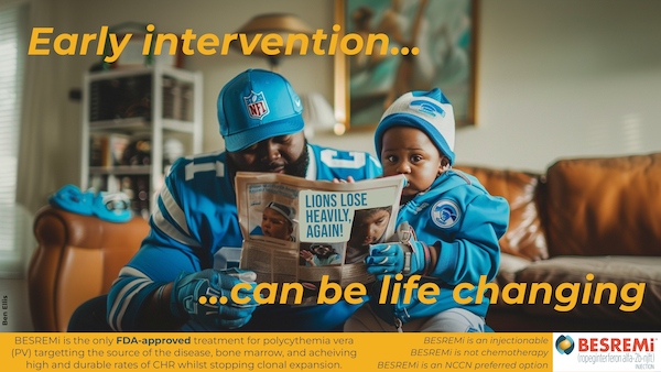 Ad Creative Copywriter